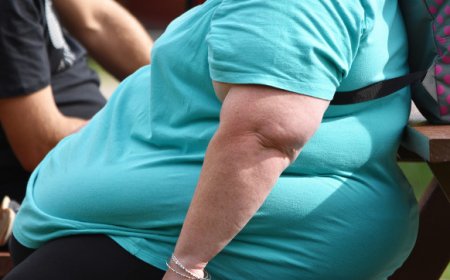 Foca em risco cardiovascular: Nova diretriz sobre obesidade e sobrepeso