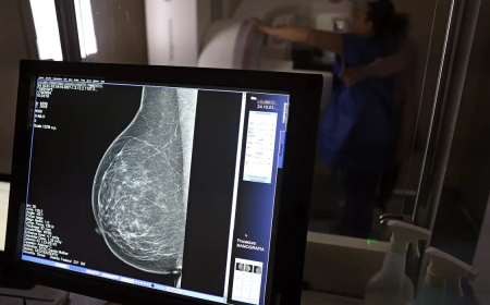 A partir dos 40 anos: Ministério da Saúde passa a recomendar mamografia