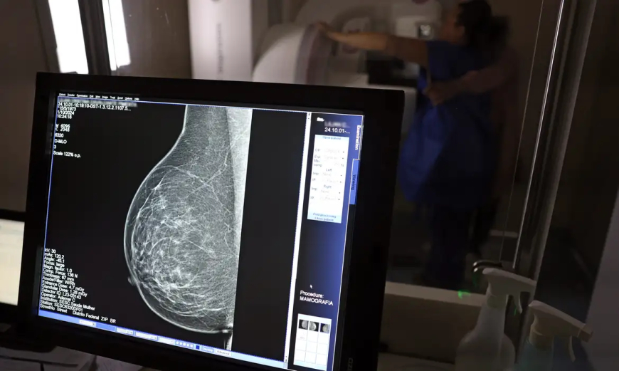 A partir dos 40 anos: Ministério da Saúde passa a recomendar mamografia