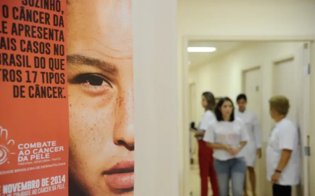 Alerta: Diagnósticos de câncer de pele no Brasil saltam de 4,2 mil para 72,7 mil em dez anos