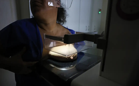 Dados do Vigitel: 92% das brasileiras entre 50 e 69 anos fizeram mamografia