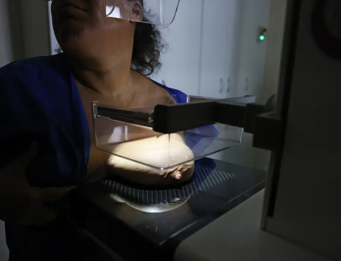 Dados do Vigitel: 92% das brasileiras entre 50 e 69 anos fizeram mamografia