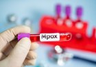 Sobe para 140 número de casos confirmados de Mpox no país, em 2026