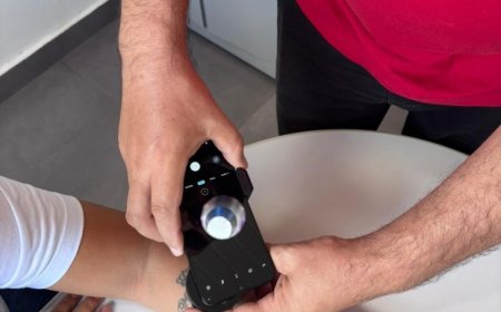 Telediagnóstico em dermatologia amplia acesso e identifica casos de câncer de pele em MS