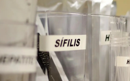 SUS passa a adotar antibiótico para prevenir sífilis e clamídia