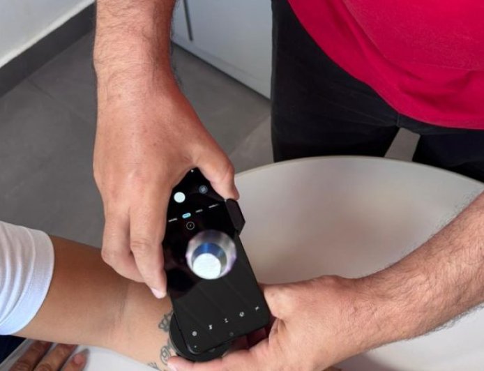 Telediagnóstico em dermatologia amplia acesso e identifica casos de câncer de pele em MS