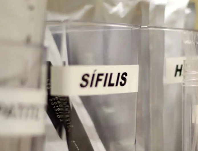 SUS passa a adotar antibiótico para prevenir sífilis e clamídia