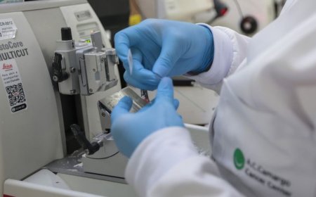 Tratamento: SUS inclui nova terapia para pacientes adultos com leucemia mieloide
