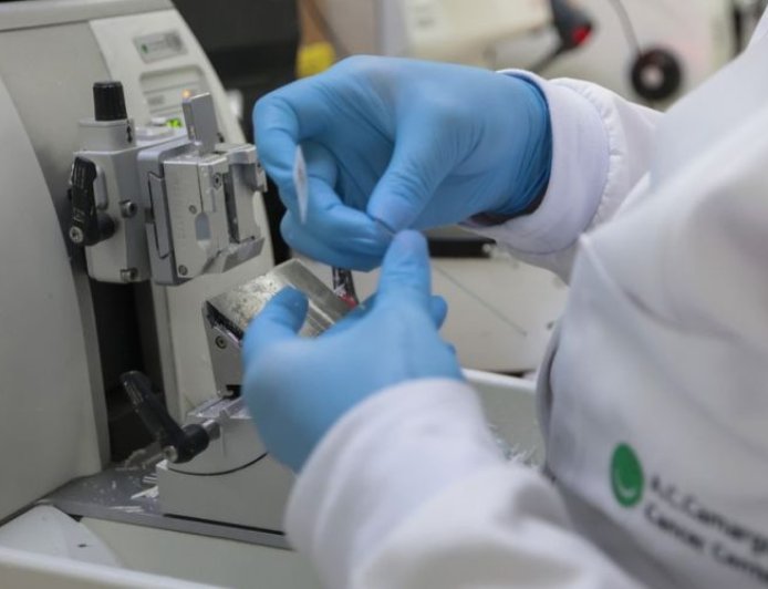 Tratamento: SUS inclui nova terapia para pacientes adultos com leucemia mieloide