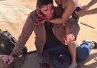Espancamento:  Jornalista é agredido violentamente em Três Lagoas