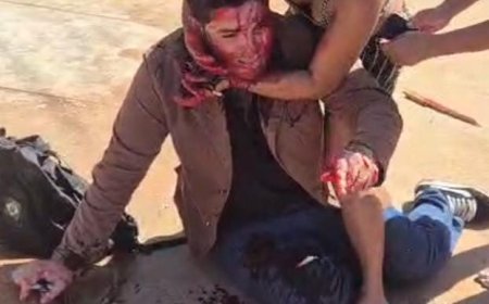 Espancamento:  Jornalista é agredido violentamente em Três Lagoas