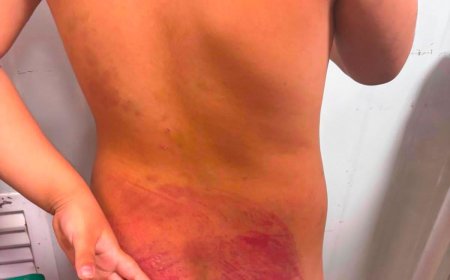 Menina autista brasileira é espancada no Paraguai. Padrasto é preso acusado de violência