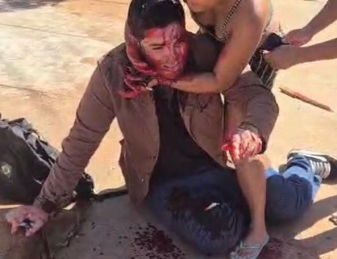 Espancamento:  Jornalista é agredido violentamente em Três Lagoas