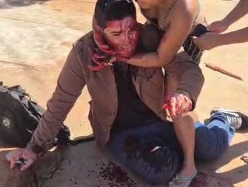 Espancamento:  Jornalista é agredido violentamente em Três Lagoas