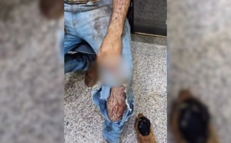 Trabalhador é atacado por uma onça durante trabalho em colheita