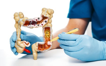 Em tratamento: Pacientes com câncer colorretal têm medicamento aprovado pela Anvisa