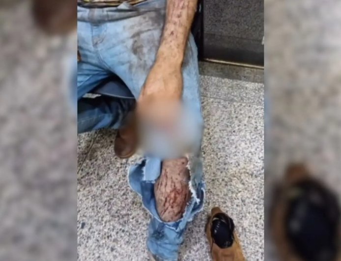 Trabalhador é atacado por uma onça durante trabalho em colheita