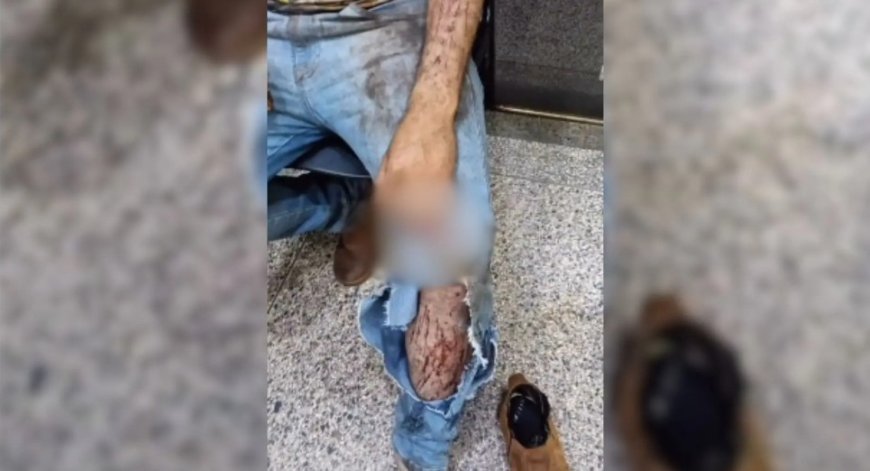 Trabalhador é atacado por uma onça durante trabalho em colheita
