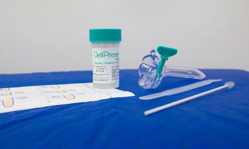 Dados: SUS detecta quase 10 mil testes positivos para HPV de alto risco